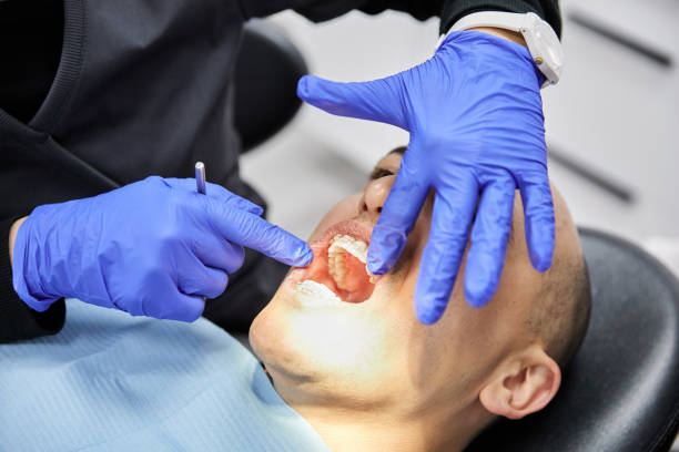 Best Emergency Treatment for Dental Infections or Abscesses in Morongo Valley, CA